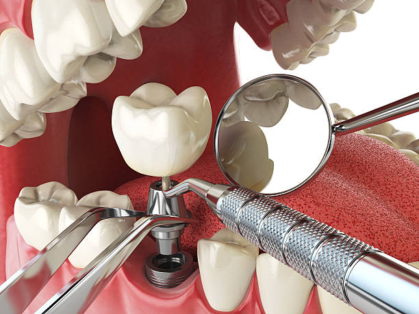 Best Emergency Gum Treatment in Prestbury, IL